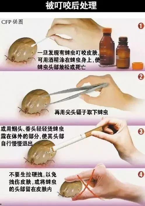 绍兴新闻爆料平台蜱虫,惊现蜱虫隐患,专家提醒防范措施! 第2张 绍兴新闻爆料平台蜱虫,惊现蜱虫隐患,专家提醒防范措施! 第2张